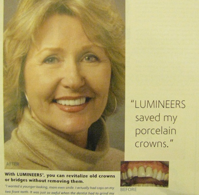 Lumineers over Crowns Advertisement