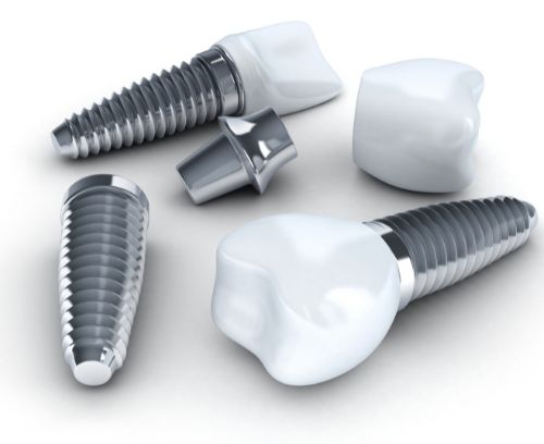 Three dental implants