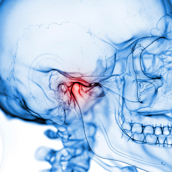X-ray side-skull view of the temporomandibular joint (TMJ)