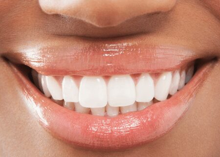 An African-American woman's closeup white smile