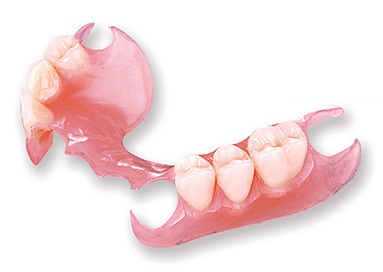 Metal-free Valplast partial denture